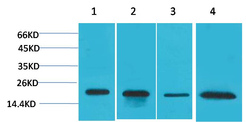 SOD1 Rabbit Polyclonal Antibody (F237)