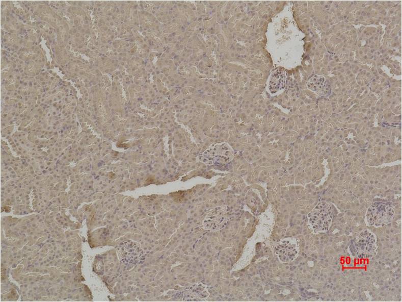 SOD1 Rabbit Polyclonal Antibody (F237)