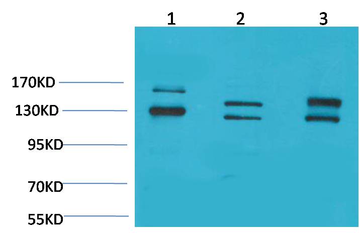BAI1 Rabbit Polyclonal Antibody (A181)