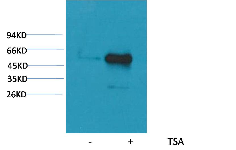 Alpha-tubulin (Acetyl Lys40) Mouse Monoclonal Antibody (4A8)
