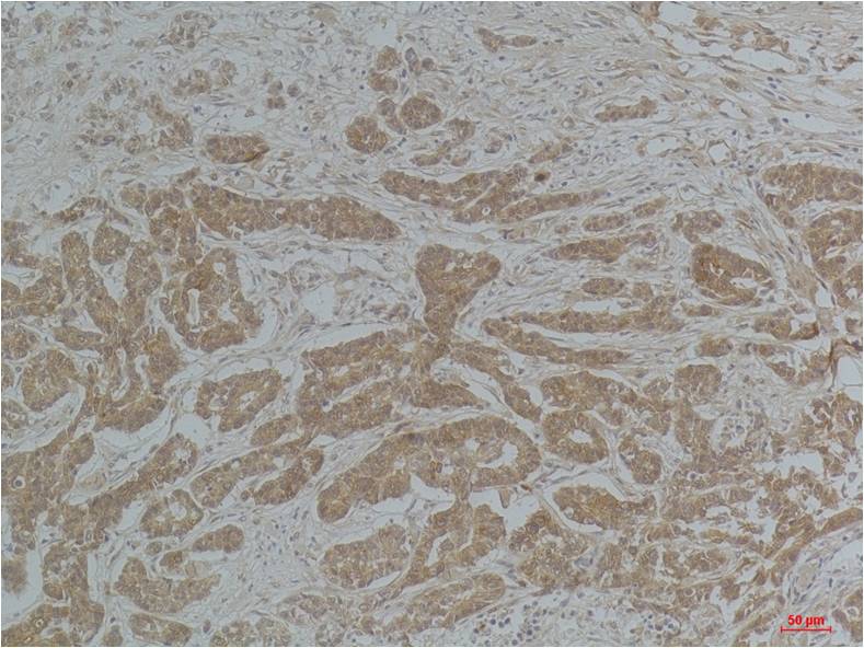 Alpha-tubulin (Acetyl Lys40) Mouse Monoclonal Antibody (4A8)