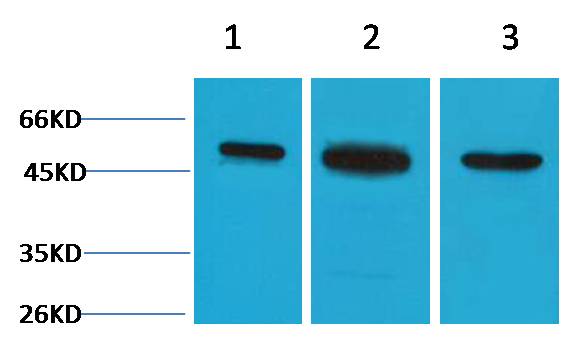Beta II Tubulin Rabbit Polyclonal Antibody
