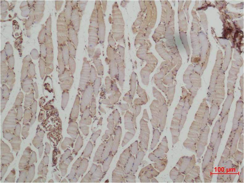 Beta II Tubulin Rabbit Polyclonal Antibody