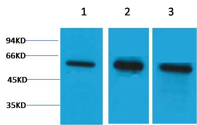 Beta Tubulin Rabbit Polyclonal Antibody