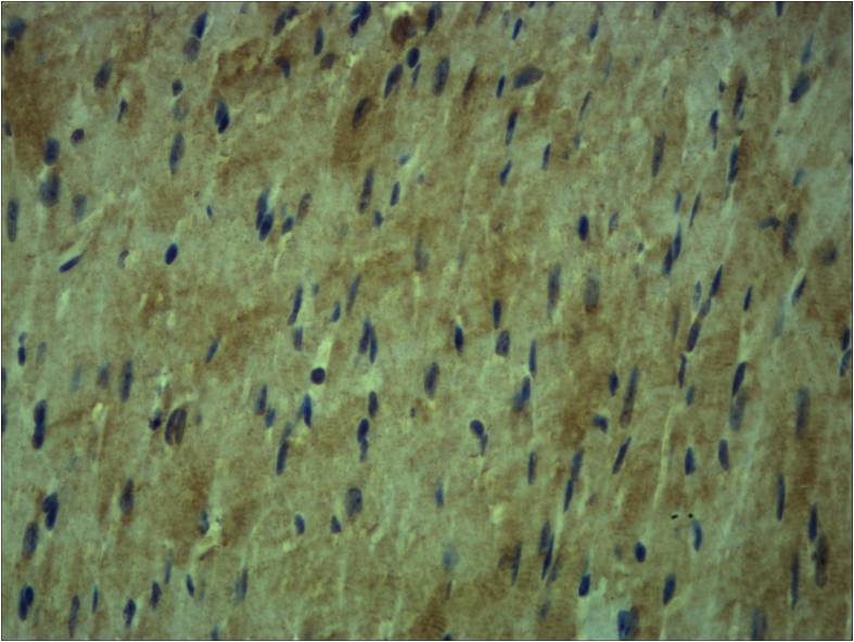 Beta Tubulin Rabbit Polyclonal Antibody