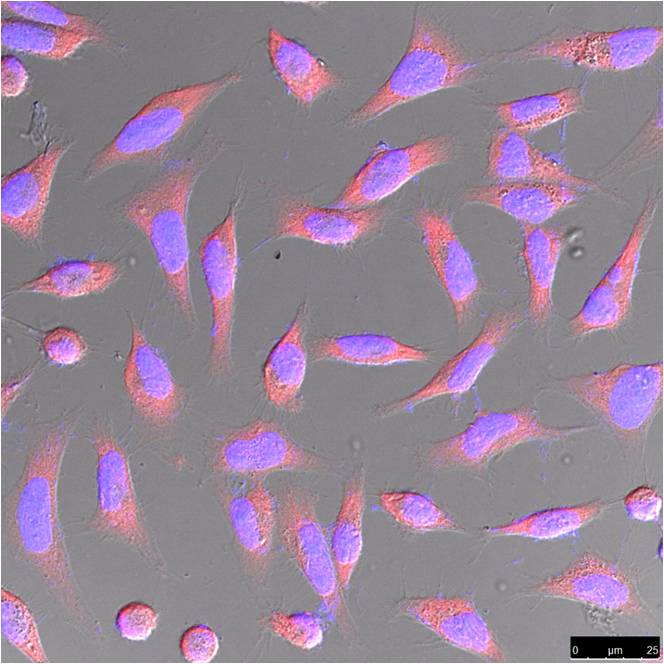 Beta-actin Rabbit Polyclonal Antibody
