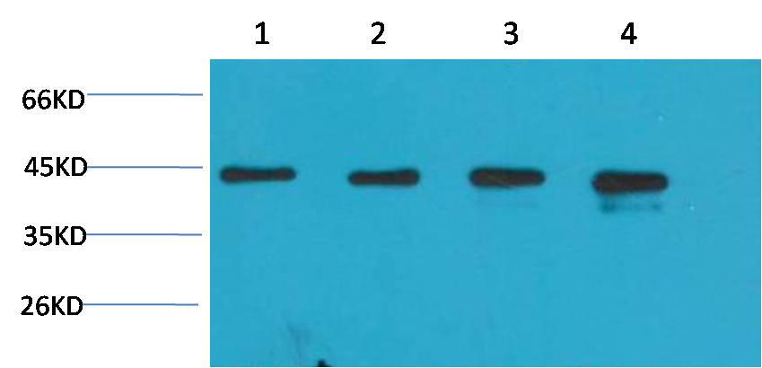Beta-actin Rabbit Polyclonal Antibody (A284)