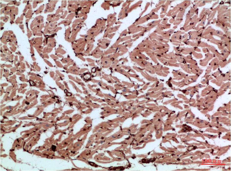 Beta-actin Rabbit Polyclonal Antibody (A284)