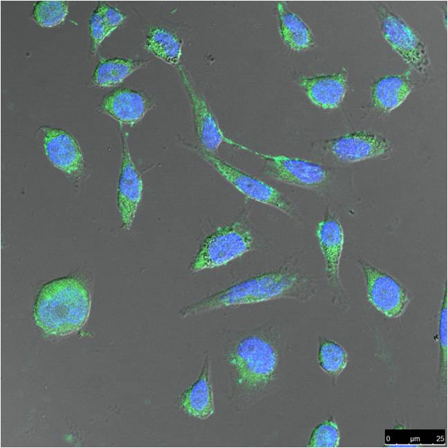 FH Fumarase Monoclonal Antibody (2B11)