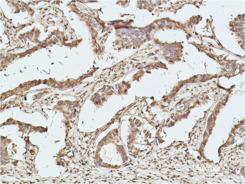 Histone H2B Monoclonal Antibody (Mix-mA)