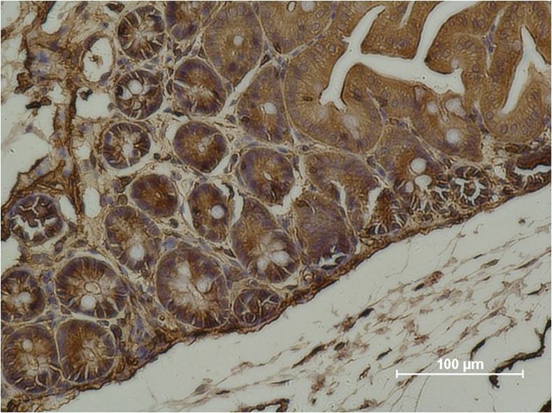 Alpha-Smooth Muscle Actin Monoclonal Antibody (1E12)