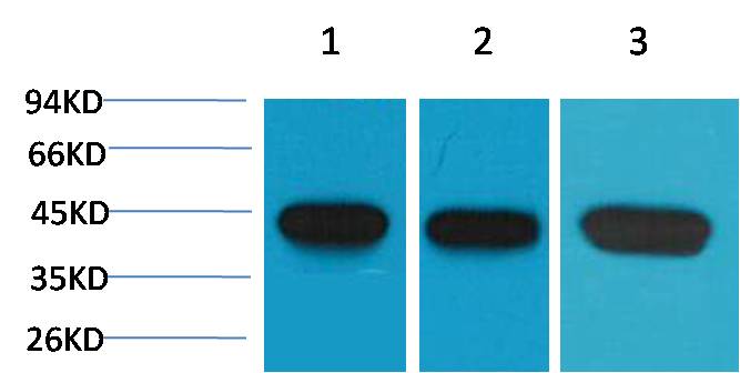 Alpha-Smooth Muscle Actin Monoclonal Antibody (6A12)