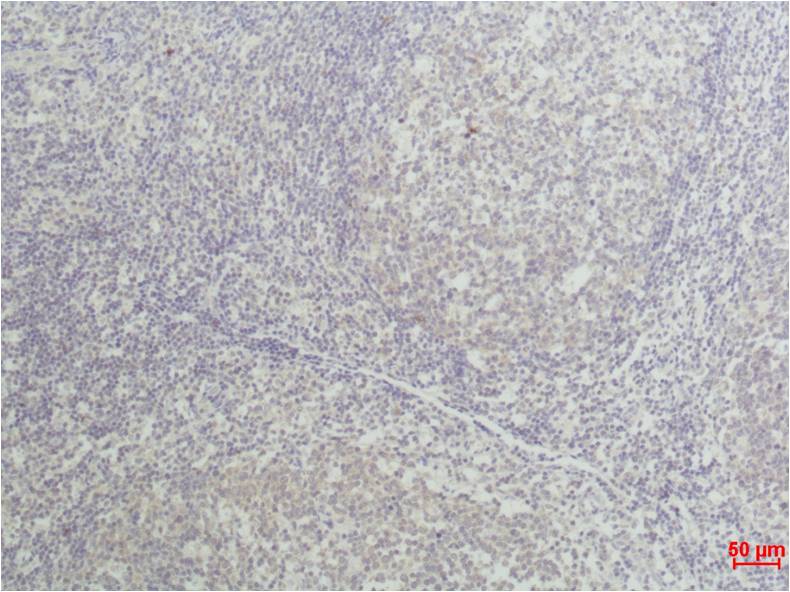 TNF Alpha Monoclonal Antibody (Q34)