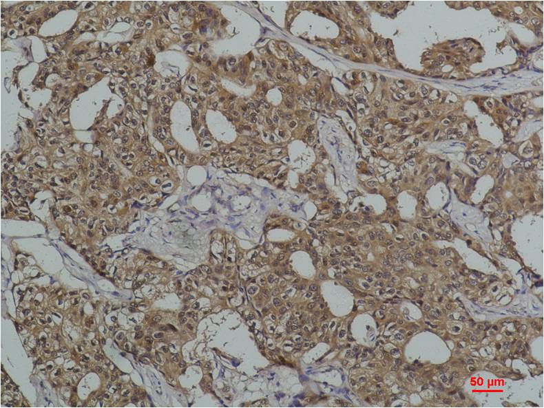 HSC70 Monoclonal Antibody (8G7)