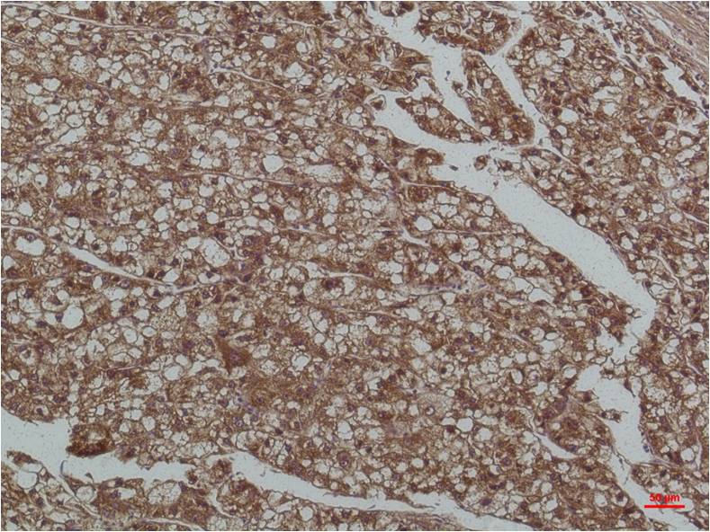 Smad3 Monoclonal Antibody (8B5)