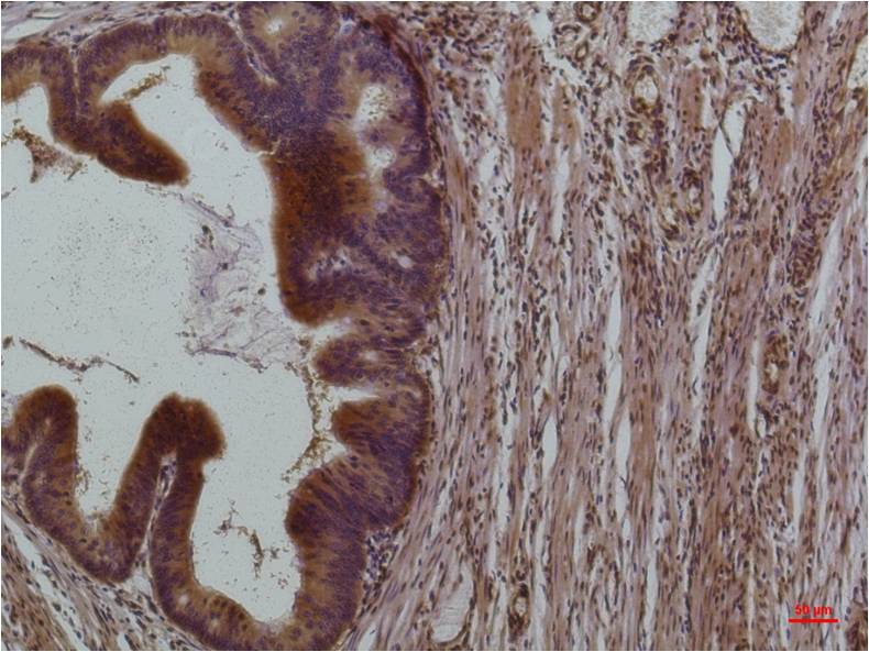 STAT3 Monoclonal Antibody (3F4)