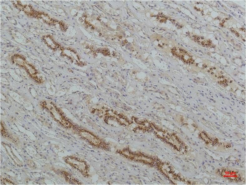 IkB Beta Monoclonal Antibody (8D11)