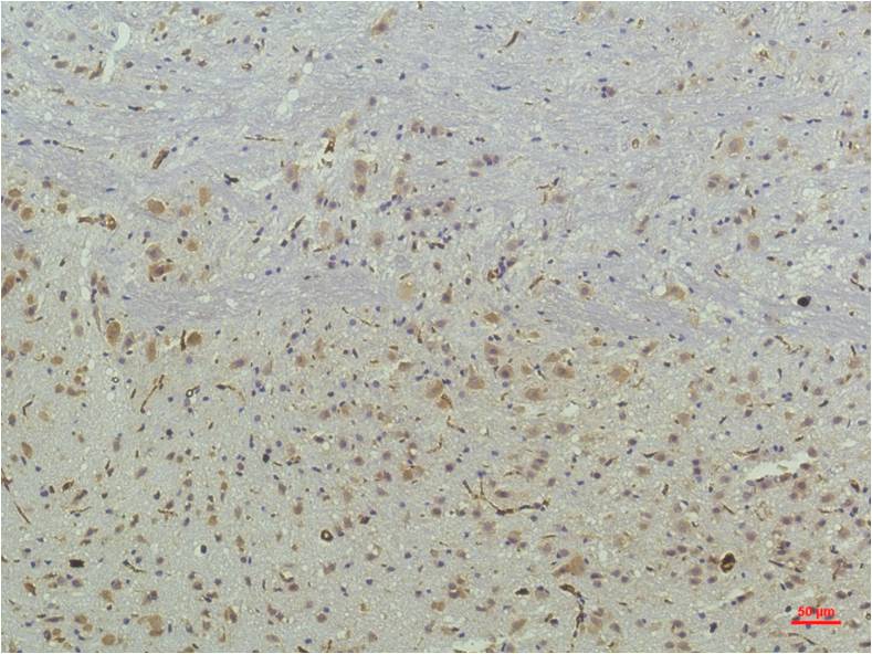 PPAR Delta Monoclonal Antibody (2F9)