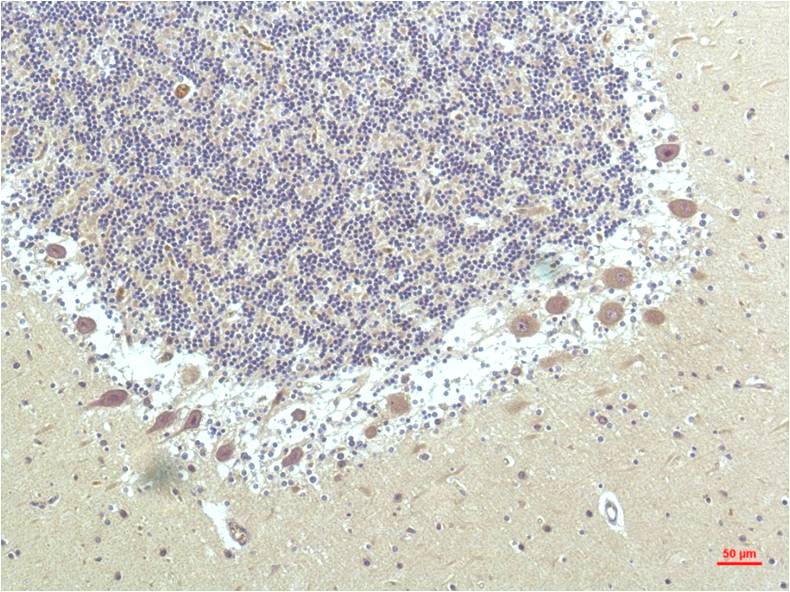 PPAR Delta Monoclonal Antibody (1D7)