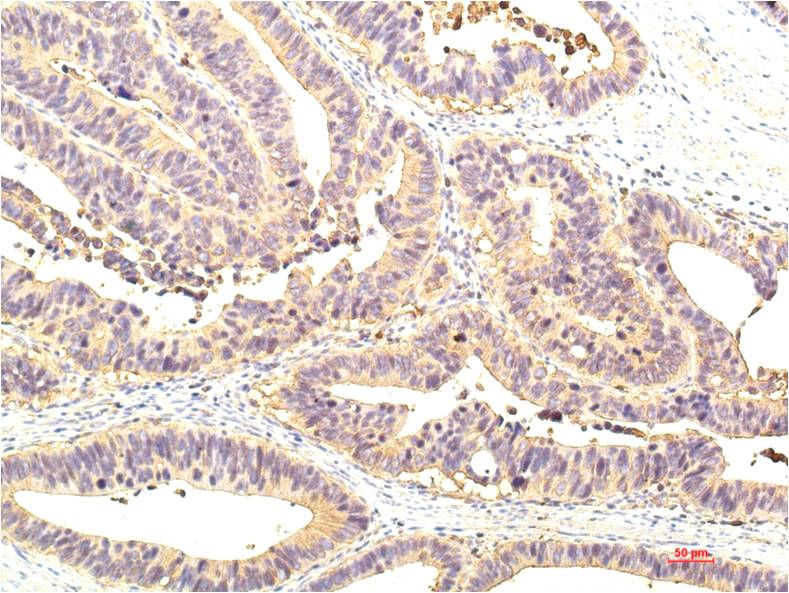 STAT1 Monoclonal Antibody (8H11)