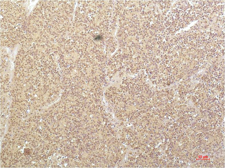 SGK1 Monoclonal Antibody (4D12)