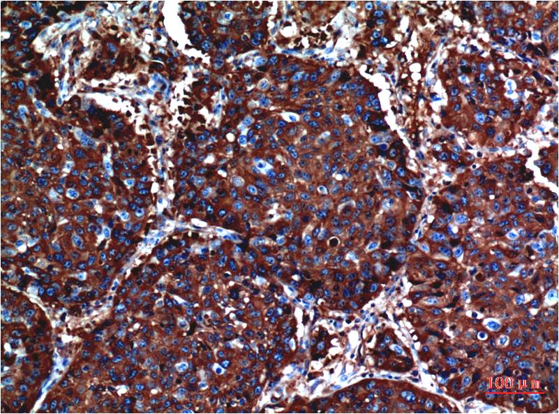 Akt Monoclonal Antibody (10D6)