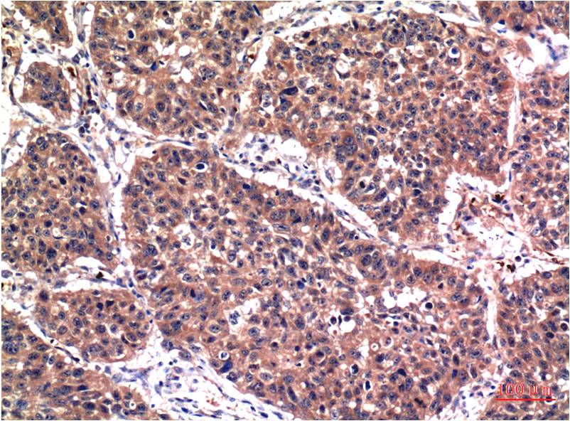 Akt (Phospho Ser473) Monoclonal Antibody (6F8)