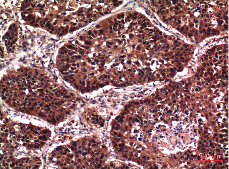 Akt (Phospho Ser473) Monoclonal Antibody (7F9)