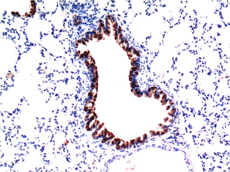 TGFBeta1 Monoclonal Antibody (5D2)