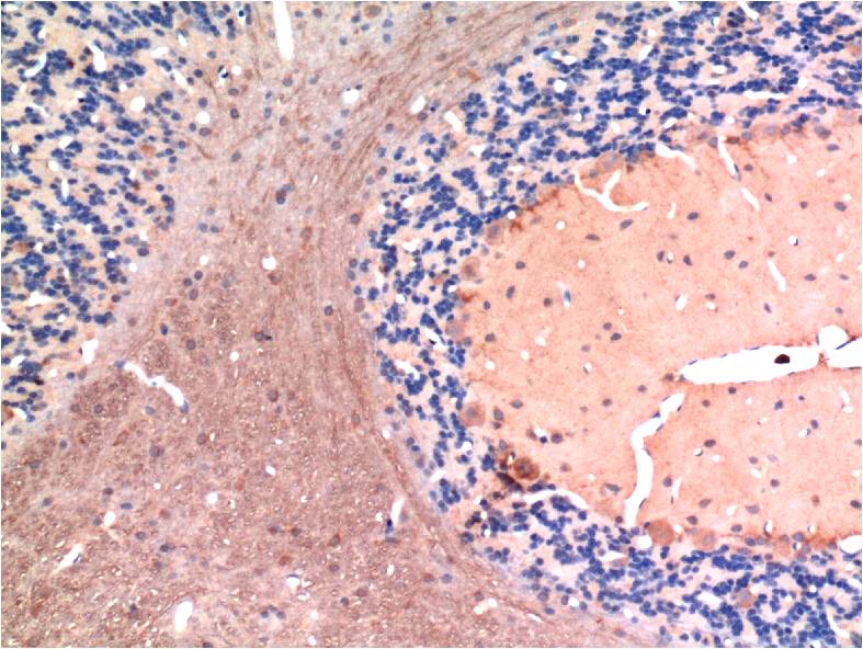 TGFBeta1 Monoclonal Antibody (5D2)