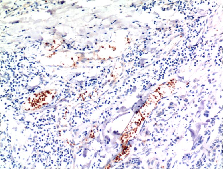 TGFBeta1 Monoclonal Antibody (10E5)