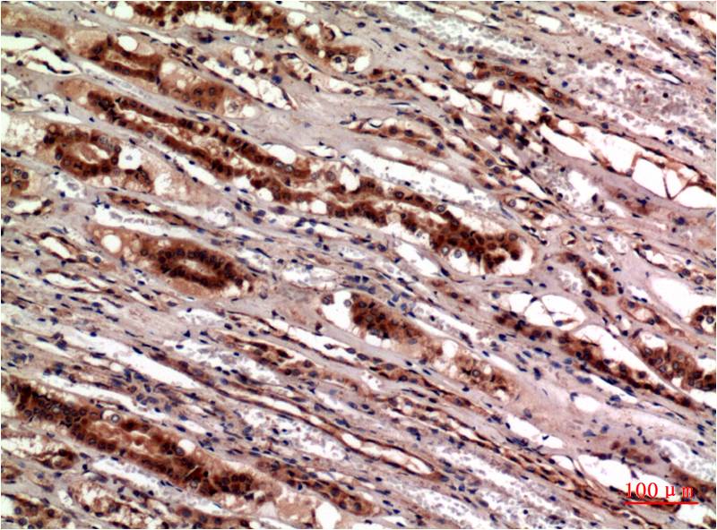 Cystatin C Monoclonal Antibody (5F1)
