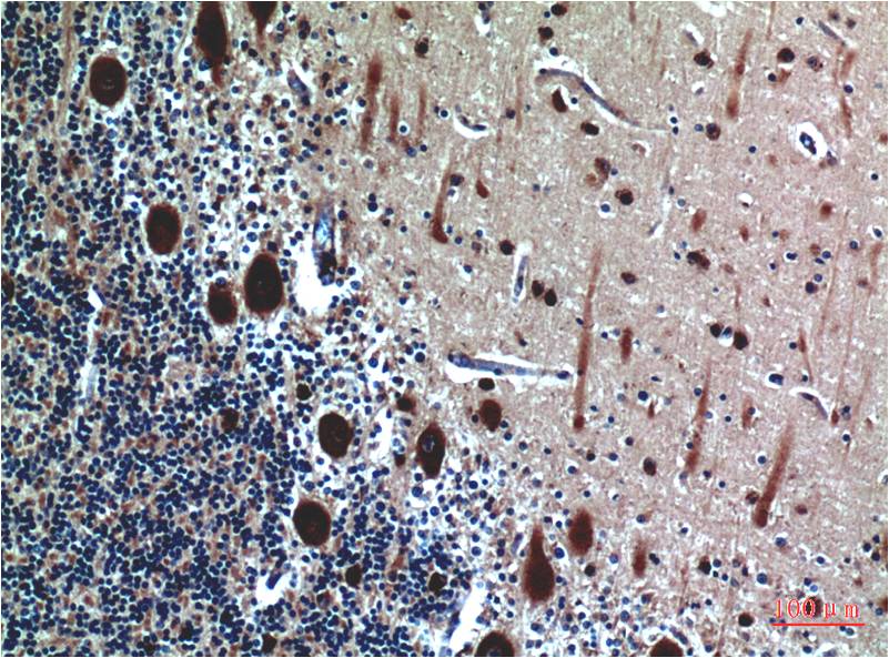 Cystatin C Monoclonal Antibody (5F1)