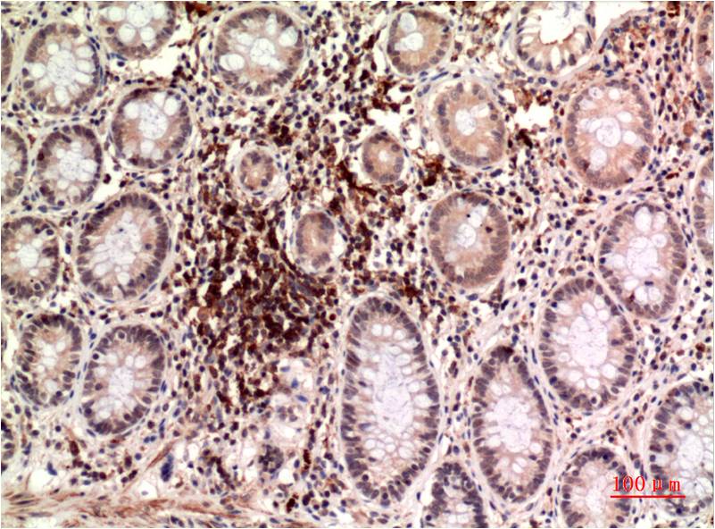 Epsilon Tubulin Monoclonal Antibody (3G1)
