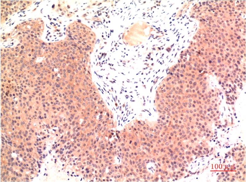 Epsilon Tubulin Monoclonal Antibody (3G1)