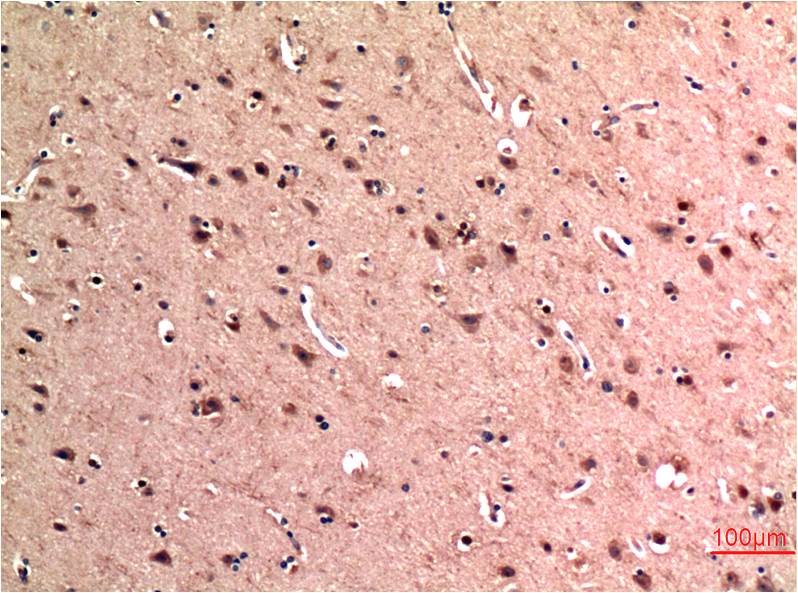 Beclin-1 Monoclonal Antibody (5C2)