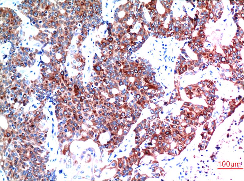 Beclin-1 Monoclonal Antibody (5A11)