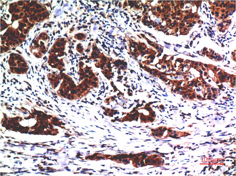 Akt Monoclonal Antibody (1E11)