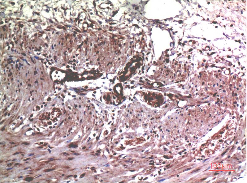 MMP2 Monoclonal Antibody (1H1)