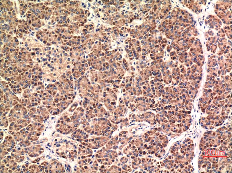 CHOP Monoclonal Antibody (1E1)