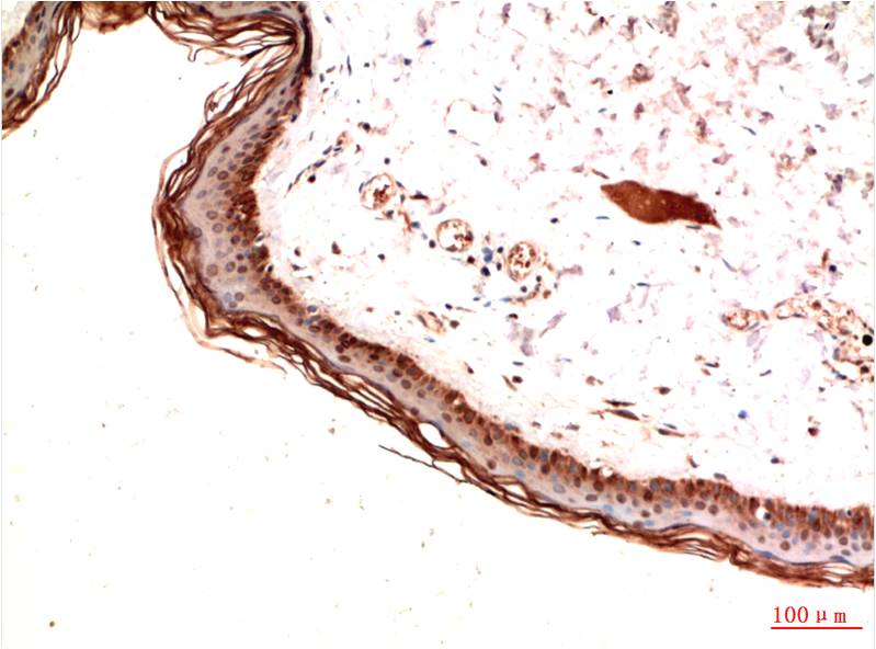 PDGFRAlpha Monoclonal Antibody (7A3)