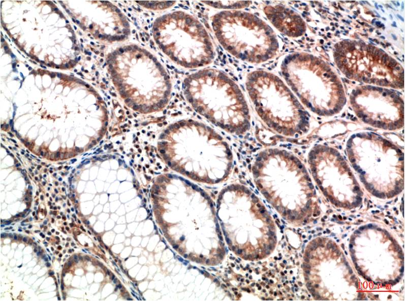 ATM Monoclonal Antibody (1D1)