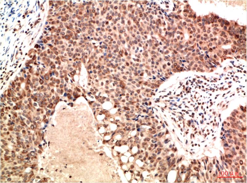 ATM Monoclonal Antibody (4G9)