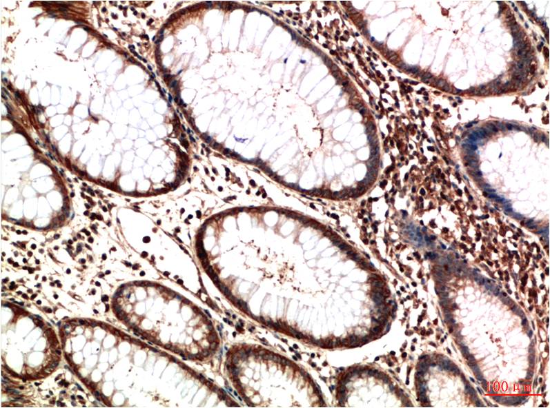 ATM Monoclonal Antibody (3D3)