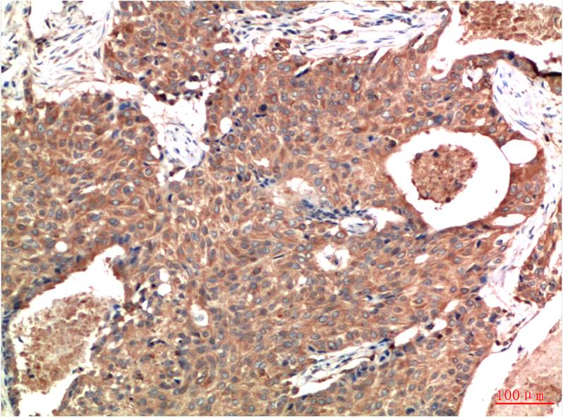 ATM Monoclonal Antibody (3D3)