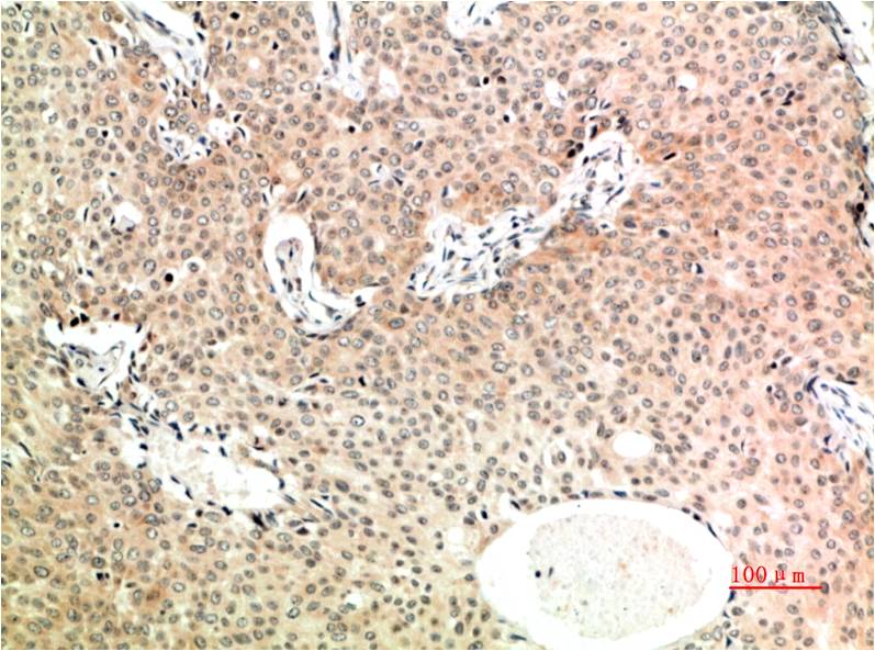 TGFBeta1 Monoclonal Antibody (4B9)