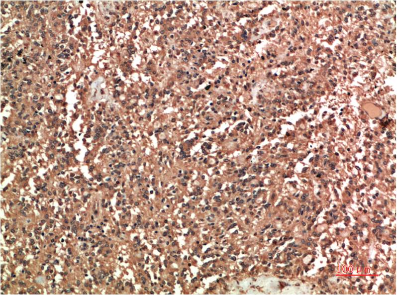 COX2 Cyclooxygenase 2 Monoclonal Antibody (6A12)