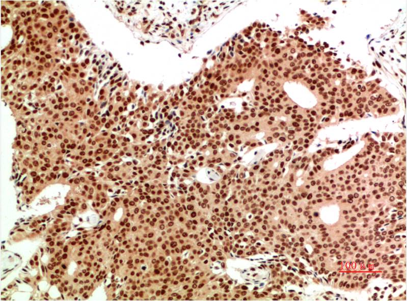 ATM Monoclonal Antibody (6B6)