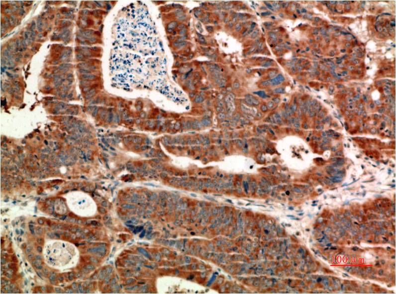 ATM Monoclonal Antibody (4C8)