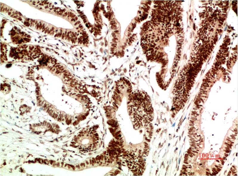ATM Monoclonal Antibody (1A9)